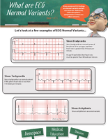 What are ECG Normal Variants